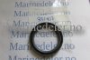 (bilde for) TETNINGSRING851407 (ettermarkedsdel)